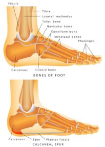 Best Work Boots for Plantar Fasciitis