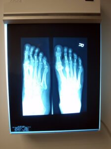 Metatarsal Work Boots: When You Need a Met Guard